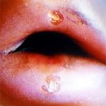 <b>Untitled</b> - (Black holes) / color photograph / 50x50 cm / edition: 3 and 2 a.p. / 1998-2000