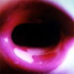 <b>Untitled</b> - (Black holes) / color photograph / 50x50 cm / edition: 3 and 2 a.p. / 1998-2000